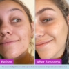toner-good-molecules-before-after