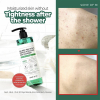 Nettoyant-contre-l'acne