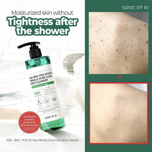 Nettoyant-contre-l'acne