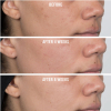 FAB-after-8-weeks