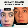 acnr-creeme-eclat