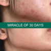 miracle-of-30-days