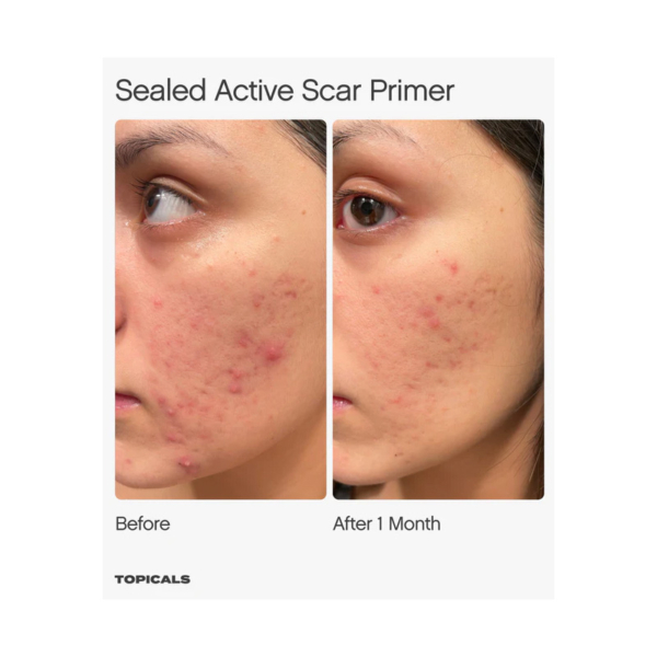 sealed-active-scar-primer