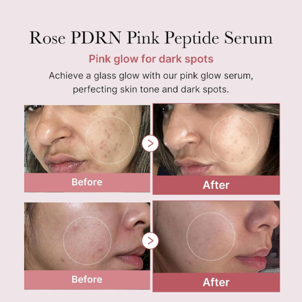 rose-pink-serum