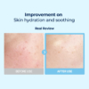 skin-impro