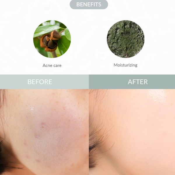 benefits-dr-althea