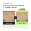 clinically-provens-serum