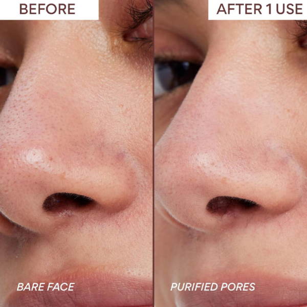 pore-clay-mask