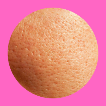 Soins anti pores dilatés