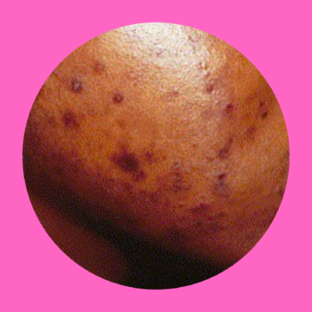 Soins anti taches & points noirs