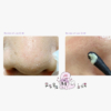 ilso-sebum