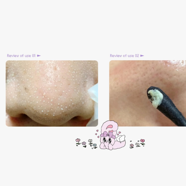 ilso-sebum