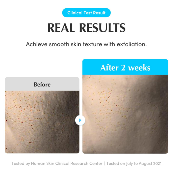 EQQUALBERRY Swimming Pool Toner – Image 3