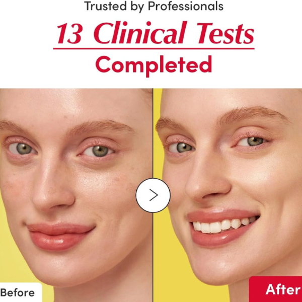 serum-serul-illiminating