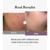 before-after-age-r-glow-toner