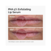 pha-exfoliatingg