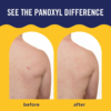 before-after-body-spray