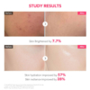before-aftermask-gel