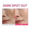 dark-spot-purito