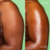 before-et-after-pour-les-bras