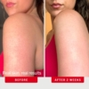 FIRST AID BEAUTY KP Bump Eraser Gommage Corporel Aux 10% d’AHA Anti-ruguosités